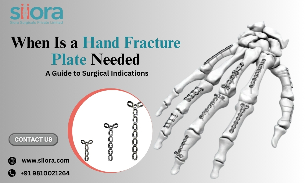 When Is a Hand Fracture Plate Needed? A Guide to Surgical Indications.